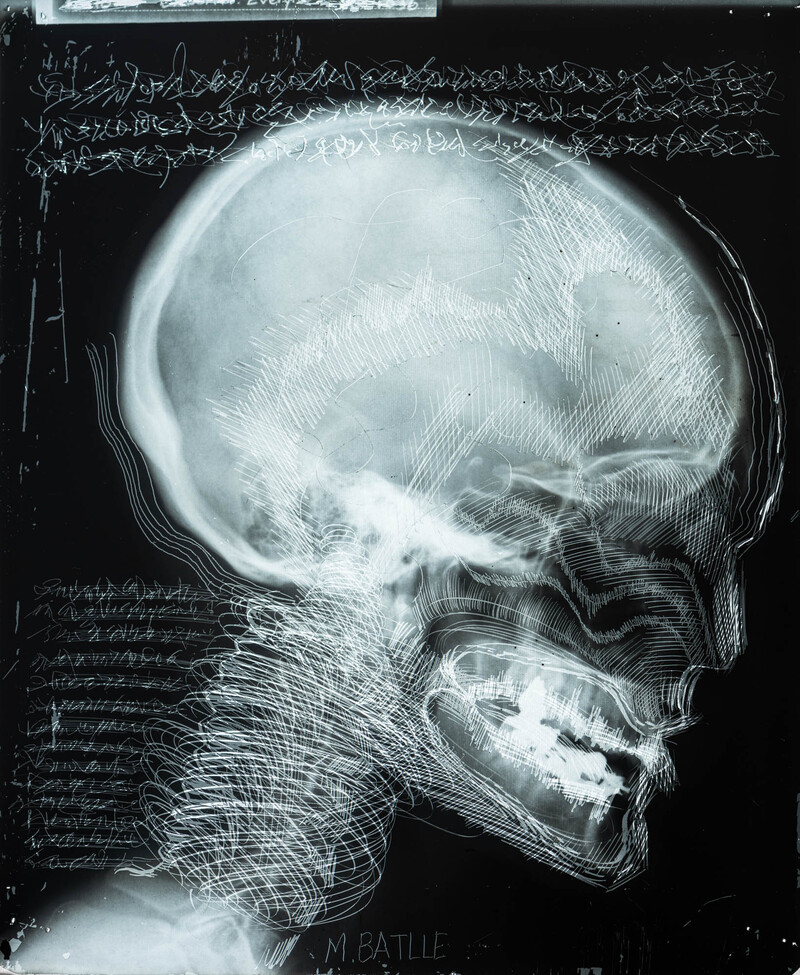 Gravure sur Radiographie par Michel Battle numérisée par digitize.art